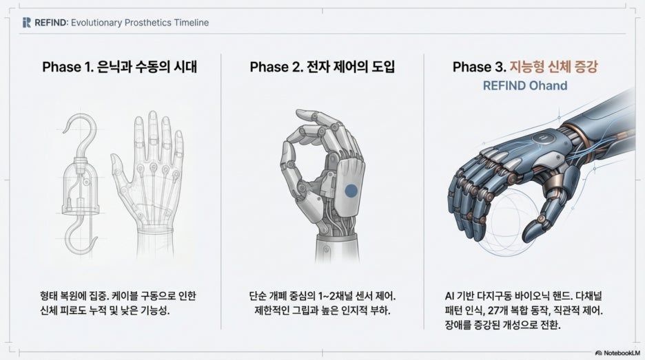 내 손처럼 움직이는 미래: 최신 전자의수 트렌드와 리파인(REFIND) Ohand 집중 분석